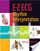 E-Z ECG Rhythm Interpretation