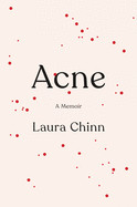 Acne: A Memoir