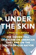 Under the Skin
