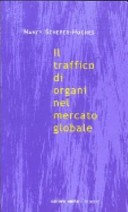 Il traffico di organi nel mercato globale