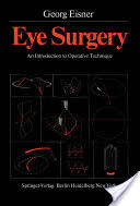 Eye Surgery