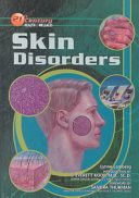 Skin Disorders