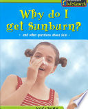 Why Do I Get a Sunburn?