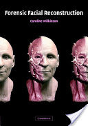 Forensic Facial Reconstruction